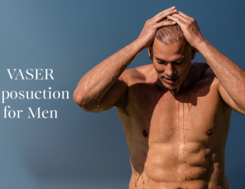 Vaser liposuction for men